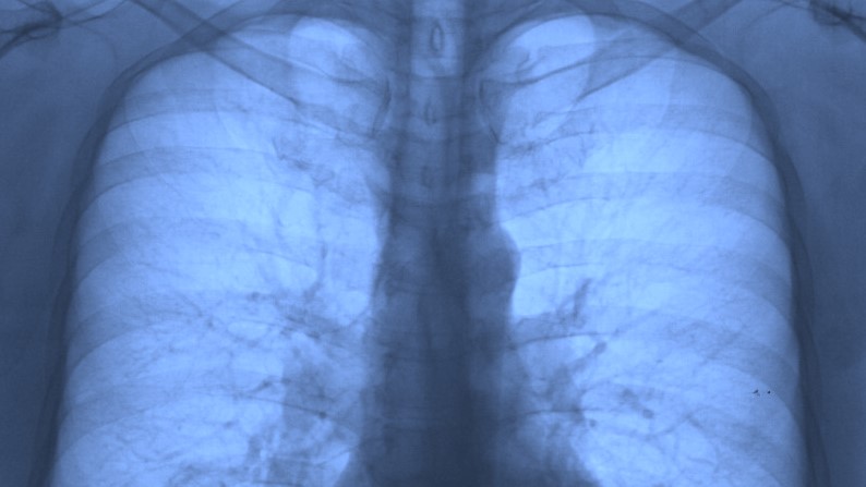 Radiología – Daniel Olivares Viniegra